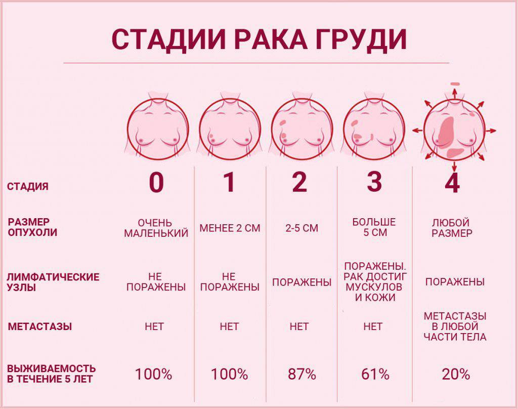Рак молочной железы как выглядит ареола Рак молочной железы как выглядит ареола